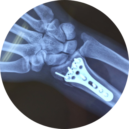 x-ray